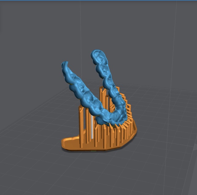 Dense support example